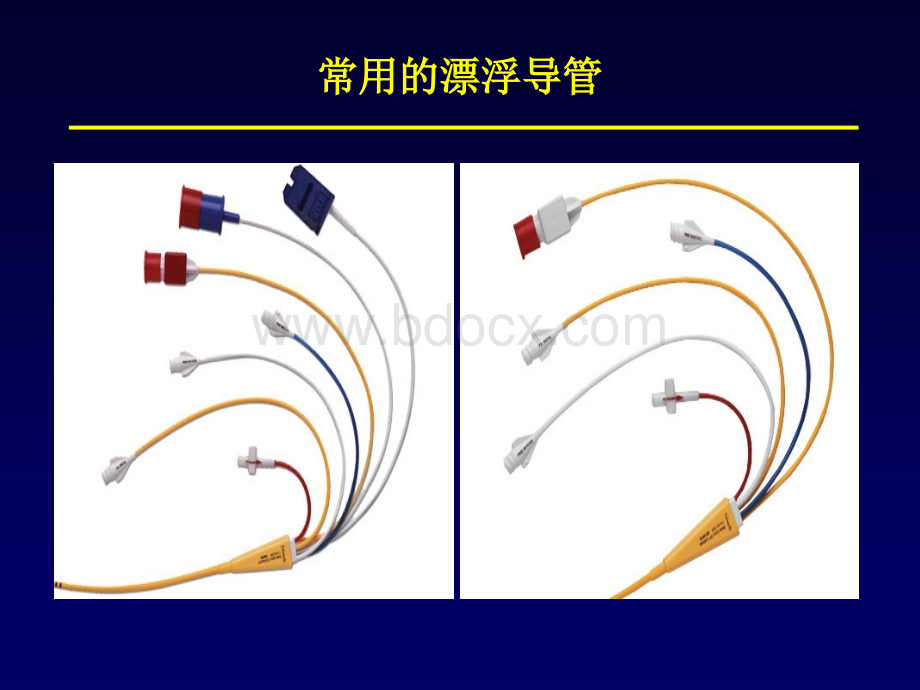 8-右心导管肺动脉造影急性肺血管反应试验-陈发东PPT格式课件下载.ppt_第3页