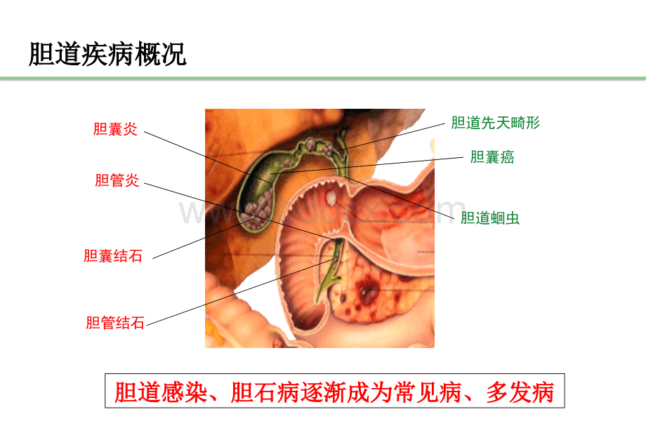 中药治疗胆系疾病PPT文件格式下载.ppt_第3页