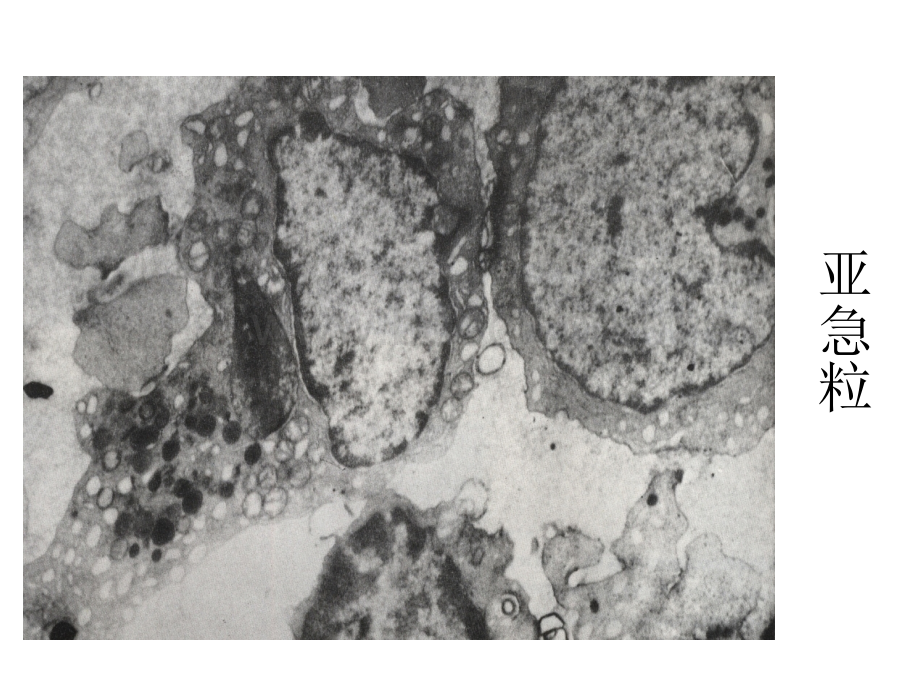 电镜下细胞形态图03.ppt_第3页