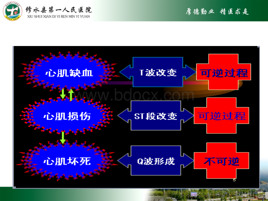 急性心肌梗死及常见心电图识别.pptx_第3页