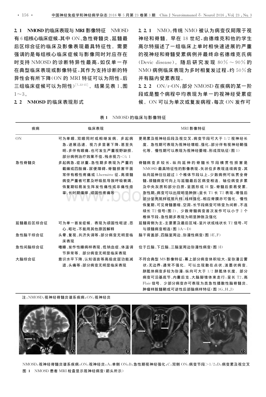 中国视神经脊髓炎谱系疾病诊断与治疗指南.pdf_第2页