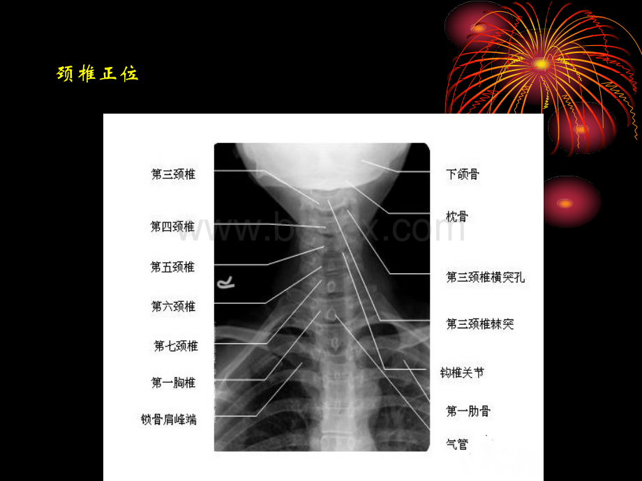 正常脊柱X线解剖优质PPT.ppt_第2页