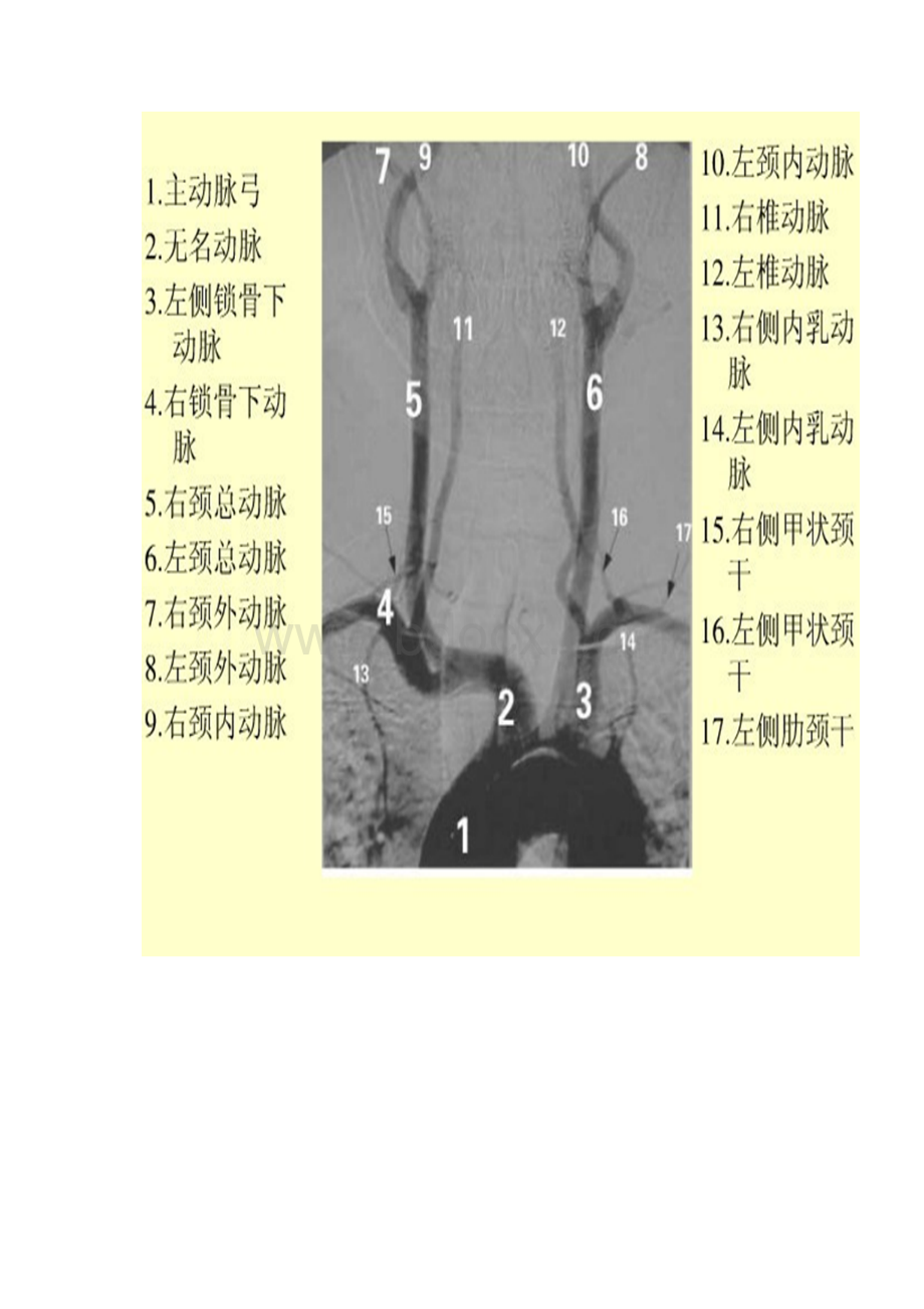 如何轻松看懂脑血管造影Word文档格式.docx_第2页