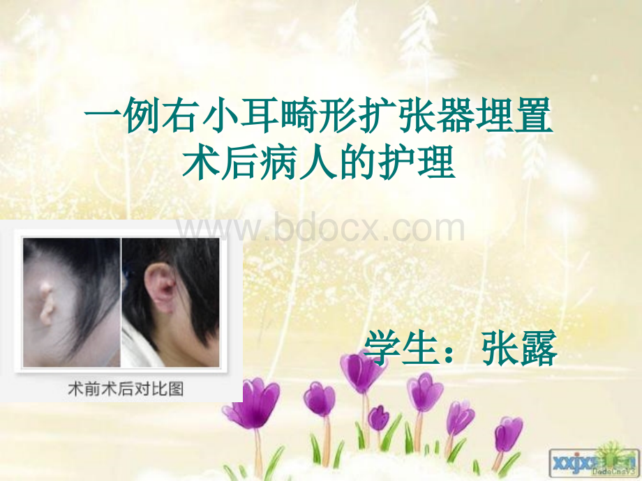 小耳畸形的护理查房和健康教育PPT推荐.ppt_第1页