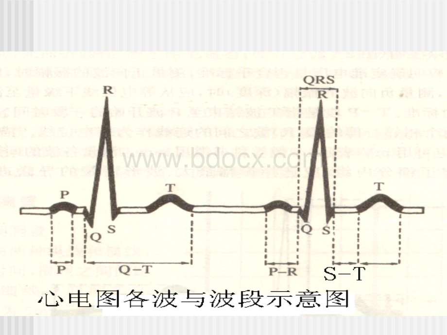 执业医师考试心电图PPT格式课件下载.ppt_第2页