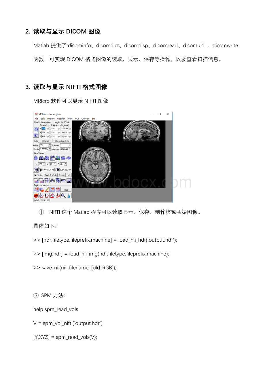 医学图像格式转换及读取与显示_精品文档Word格式.docx_第3页