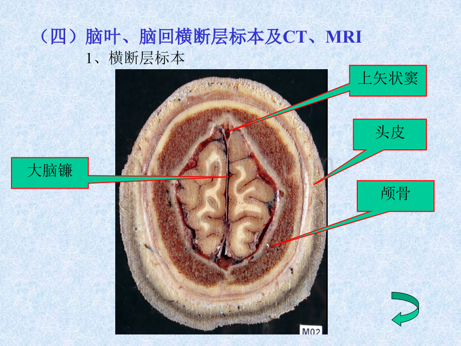 头颈部fyPPT文件格式下载.ppt