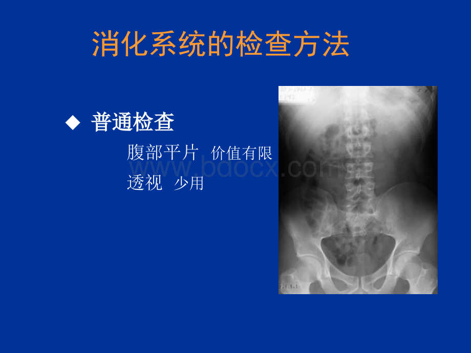 精品推荐医学影像诊断PPT课件图文详解完整版-消化系统影像诊断.ppt_第2页