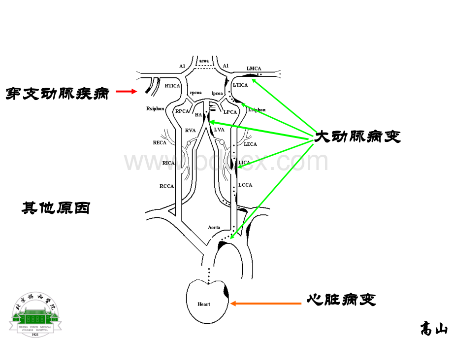 缺血性卒中的病理生理机制优质PPT.ppt_第2页