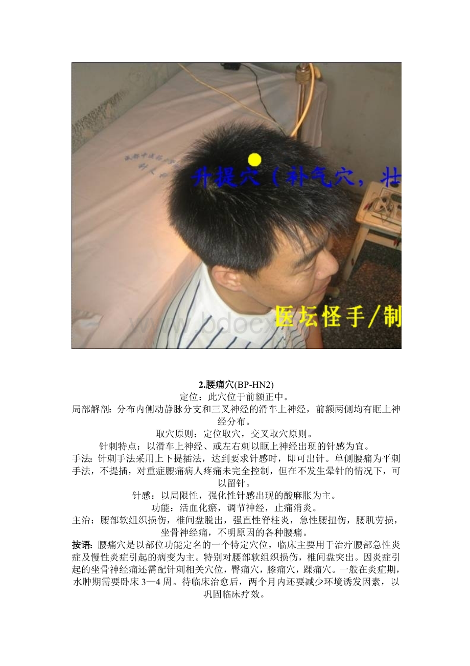 王文远平衡针灸穴位图Word文档格式.doc_第2页