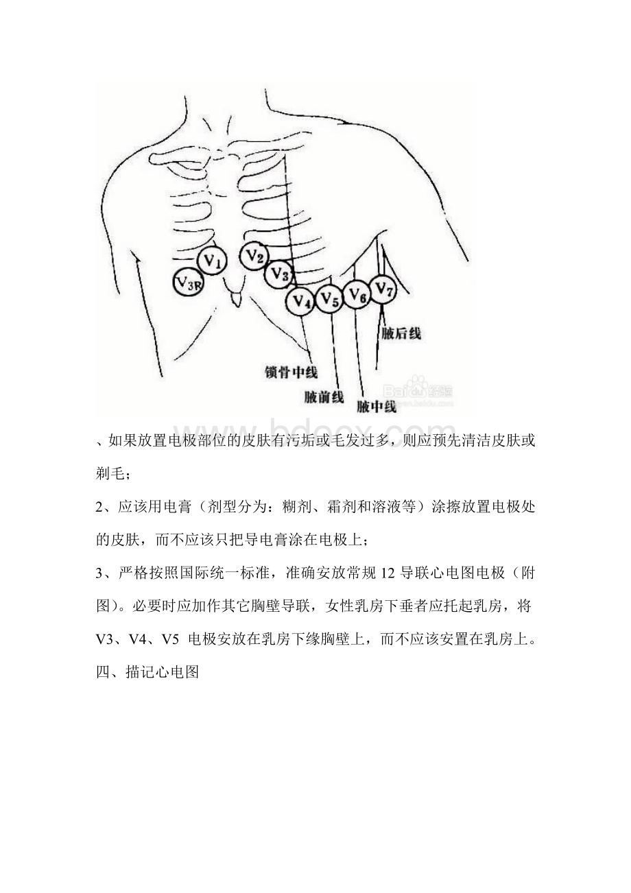 心电图操作要求及注意事项_精品文档.doc_第3页