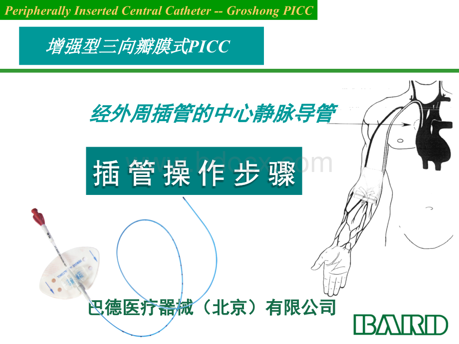 穿刺与维护PPT推荐.ppt