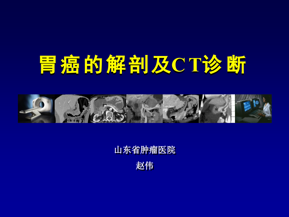 胃癌的解剖及CT诊断.ppt