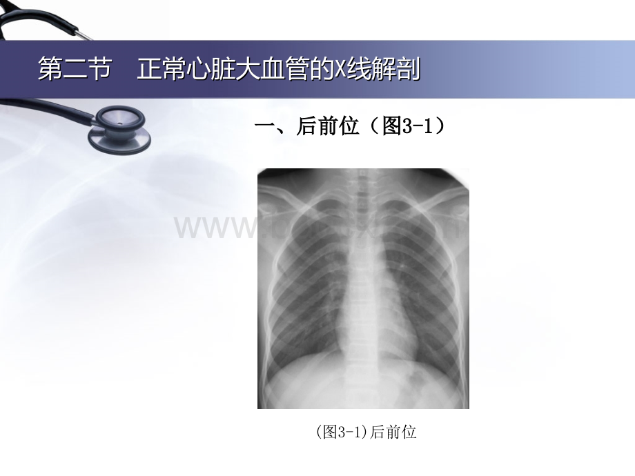 x线片快速入门3PPT文档格式.ppt_第3页