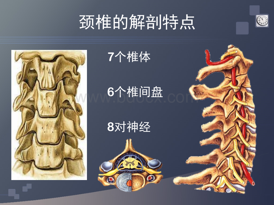 颈椎病的CT诊断_精品文档优质PPT.ppt_第3页