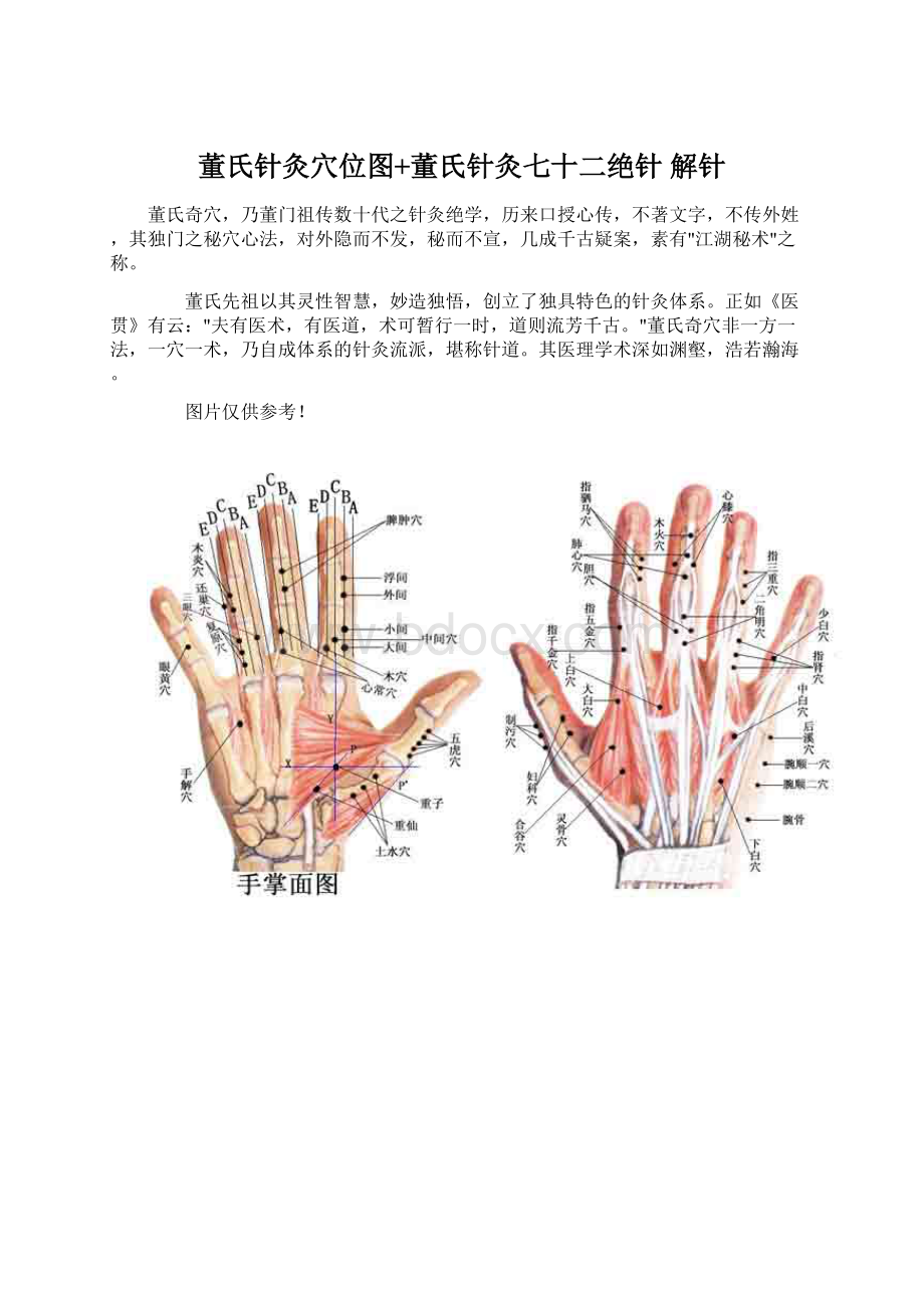 董氏针灸穴位图+董氏针灸七十二绝针 解针.docx_第1页