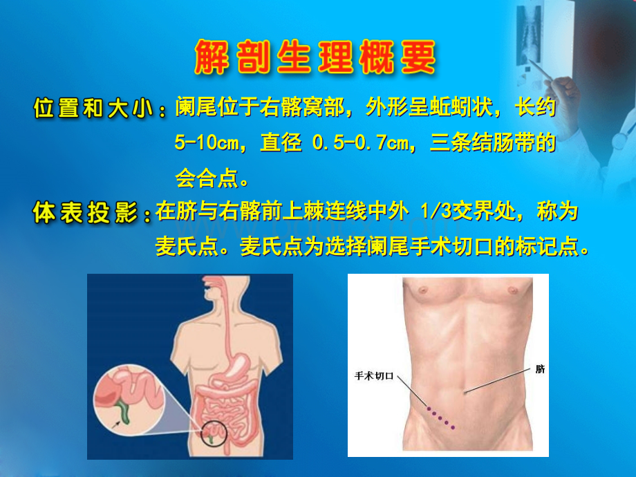 阑尾炎yj_精品文档.ppt_第2页