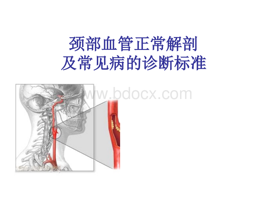 颈部血管超声正常解剖及常见病的超声诊断标准_精品文档.ppt_第1页