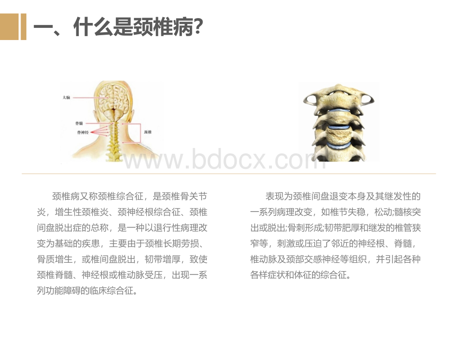颈腰椎的预防与保健_精品文档.ppt_第3页