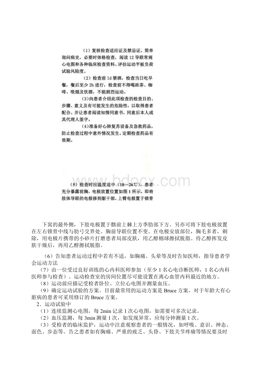 心电图运动实验.docx_第3页