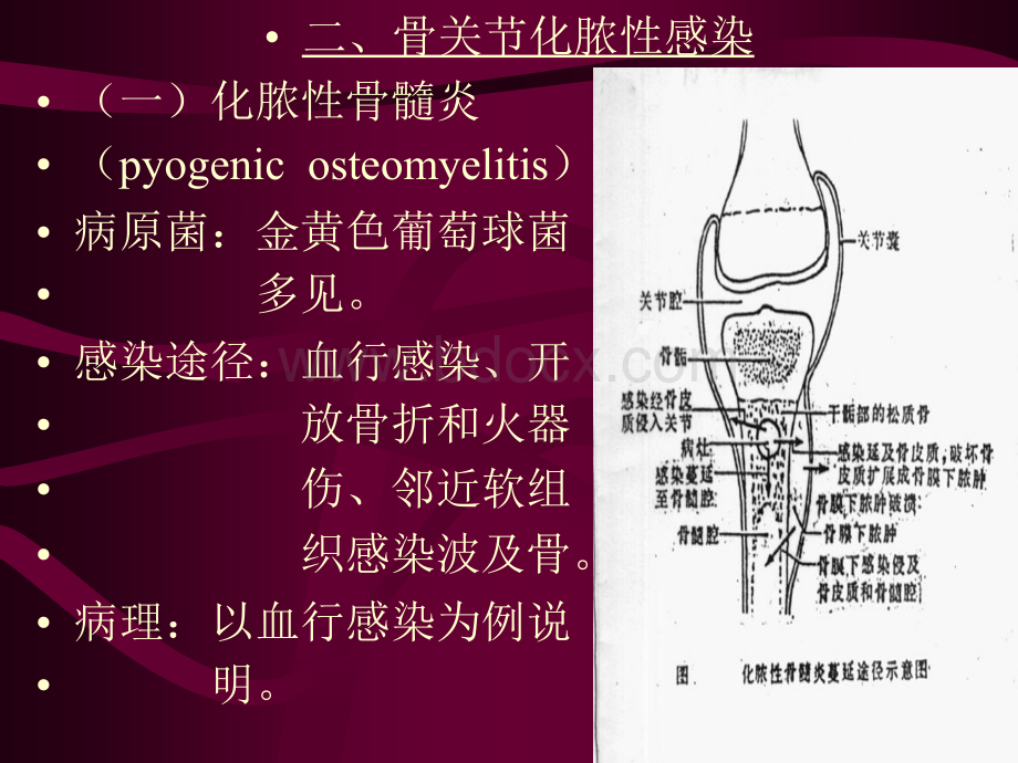 骨关节系统影像诊断学2_精品文档PPT课件下载推荐.ppt