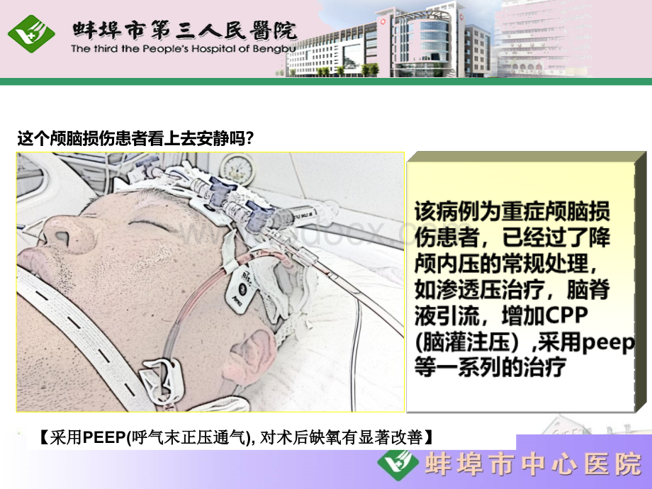 重症脑损伤患者的镇痛镇静治疗_精品文档.ppt_第2页