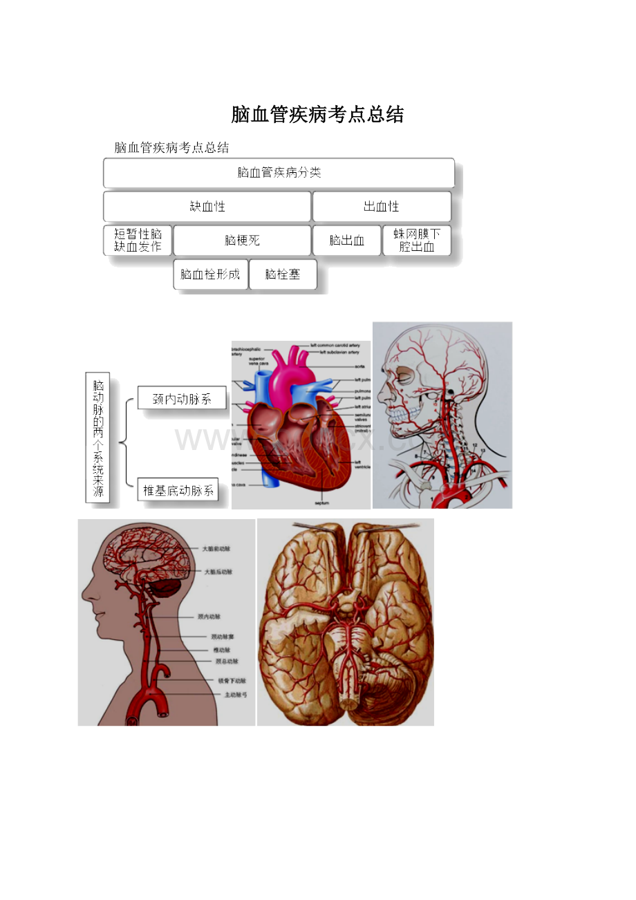 脑血管疾病考点总结.docx