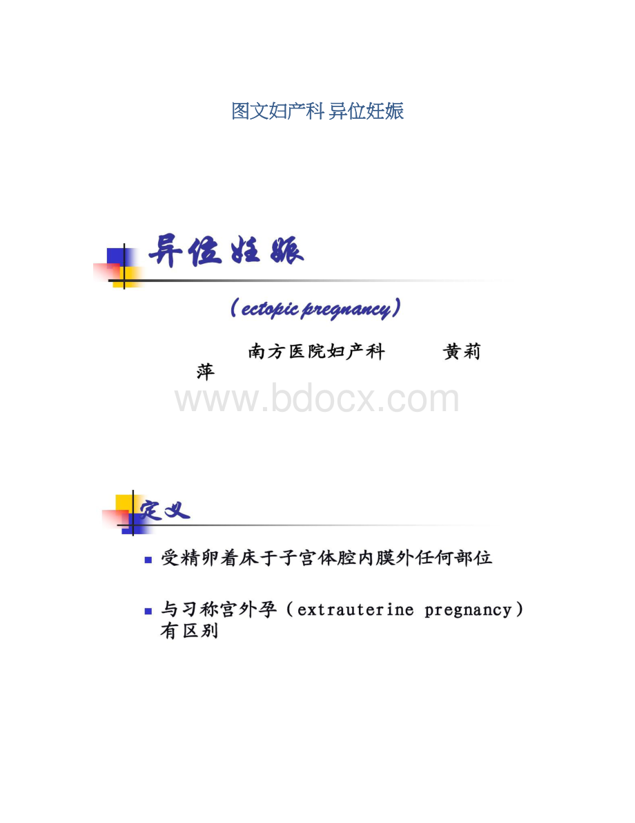 图文妇产科 异位妊娠Word文件下载.docx_第1页