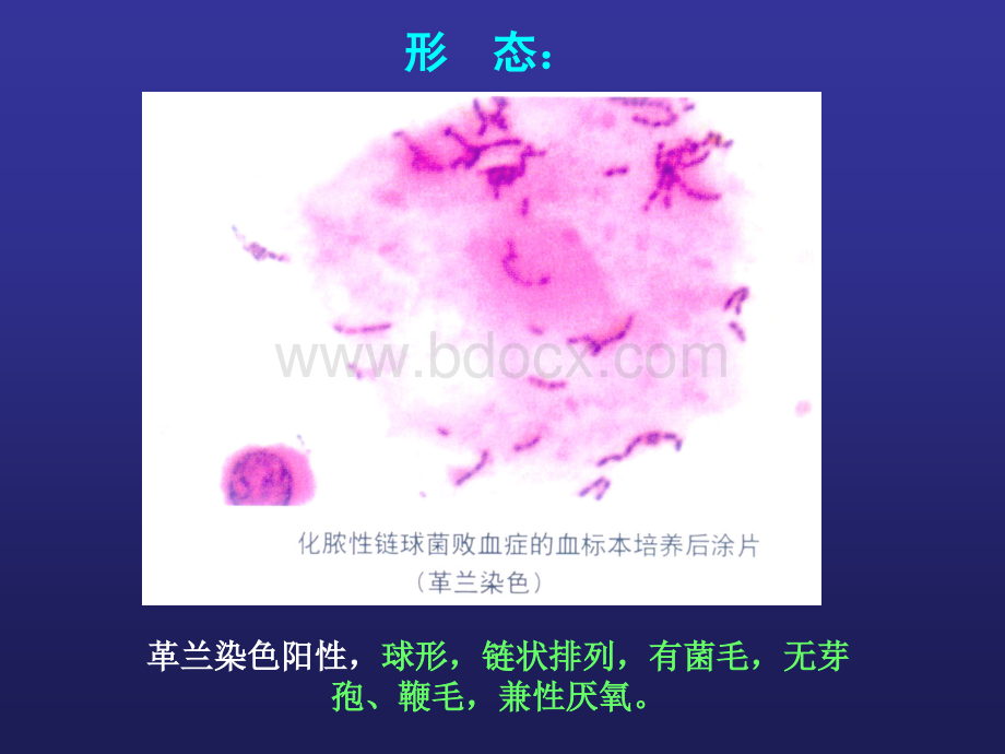 链球菌感染幻灯med126com_精品文档.ppt_第2页