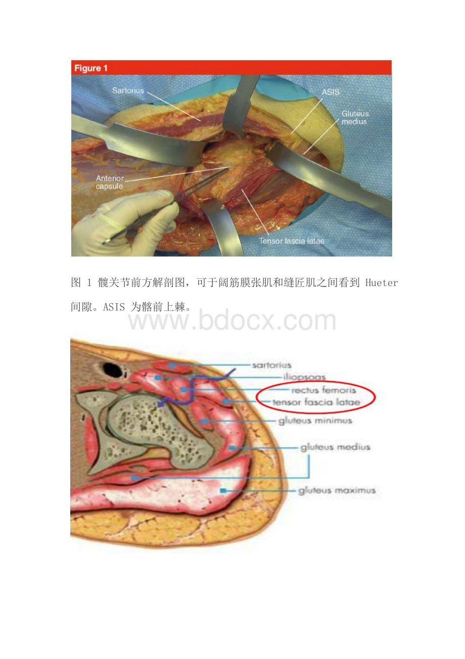 髋关节直接前入路_精品文档Word格式文档下载.docx_第3页