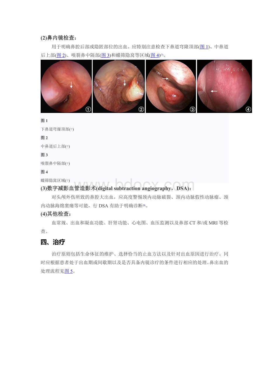 鼻出血诊断及治疗指南草案_精品文档.doc_第2页