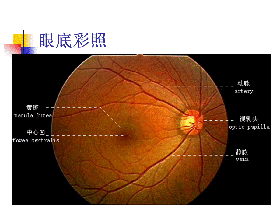 视网膜中央静脉阻塞的诊断及治疗.ppt_第3页
