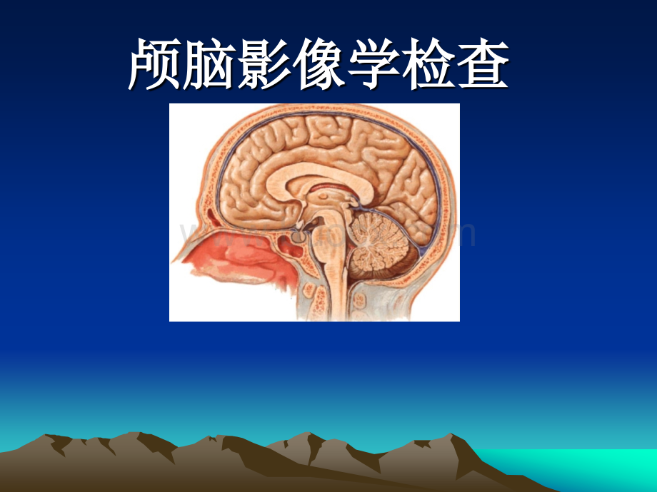 颅脑影像学检查_精品文档.ppt