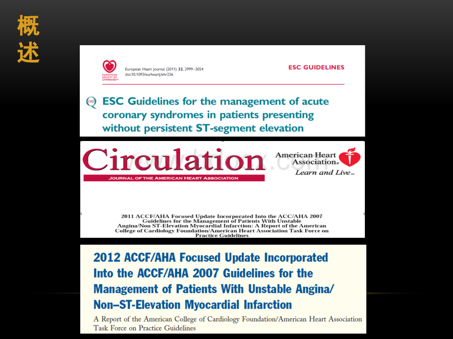 非ST段抬高ACS指南未解决问题_精品文档.ppt_第2页