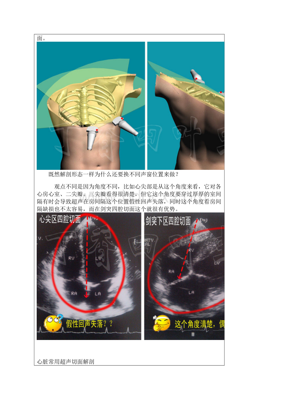 3D图解心脏解剖与心脏超声切面Word文档下载推荐.docx_第3页