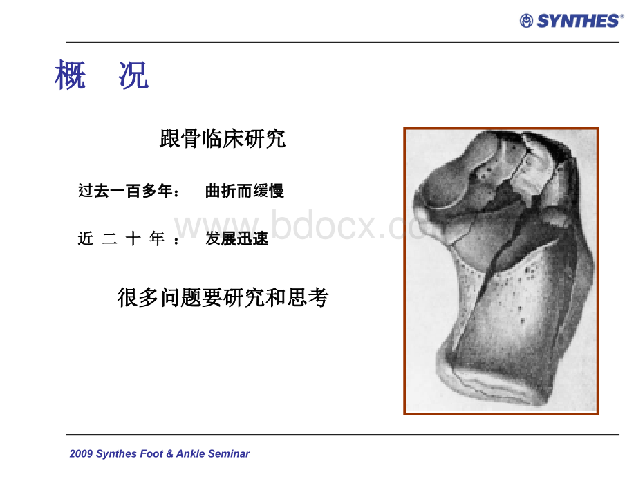 跟骨骨折的检查与分类_精品文档PPT文档格式.ppt_第2页