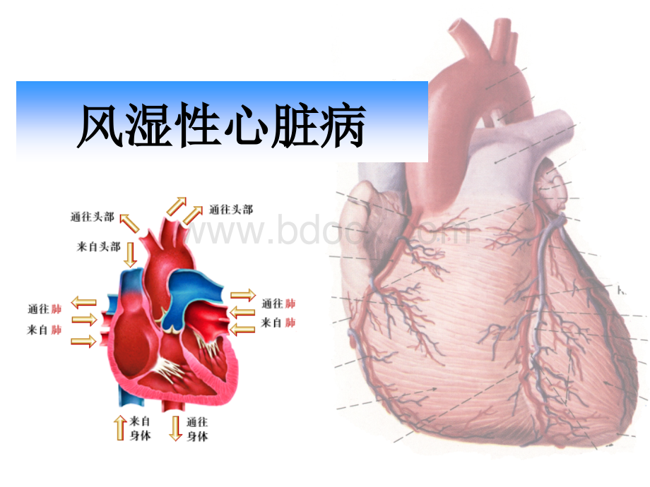 风湿性心脏病影像诊断与鉴别_精品文档PPT文档格式.ppt_第1页