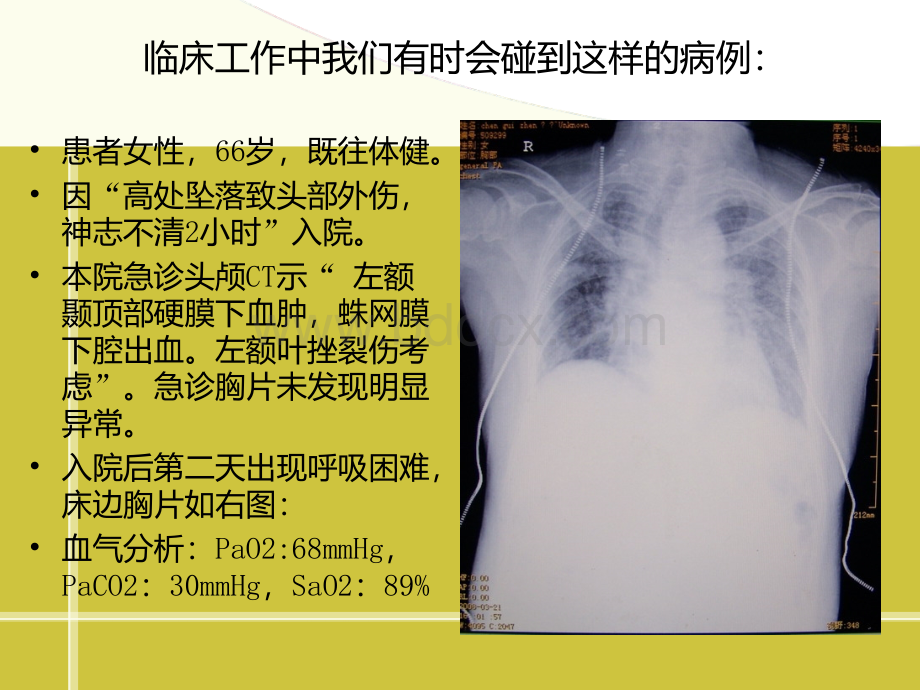 顽固性低氧血症的诊治_精品文档PPT文件格式下载.ppt_第2页