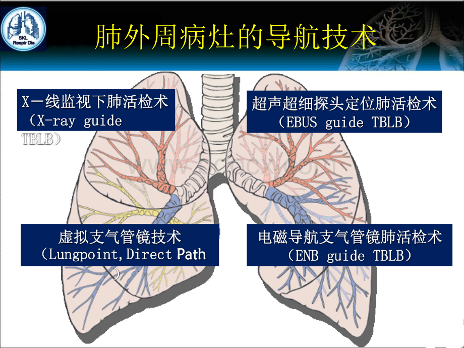 陈愉教授-电磁导航支气管镜技术在介入肺脏病的应用-上海_精品文档.ppt_第2页