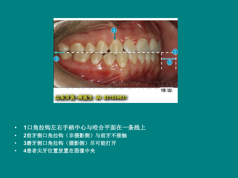 跟我学口腔摄影-拍摄美国正畸协会ABO口内像_精品文档PPT推荐.ppt_第3页