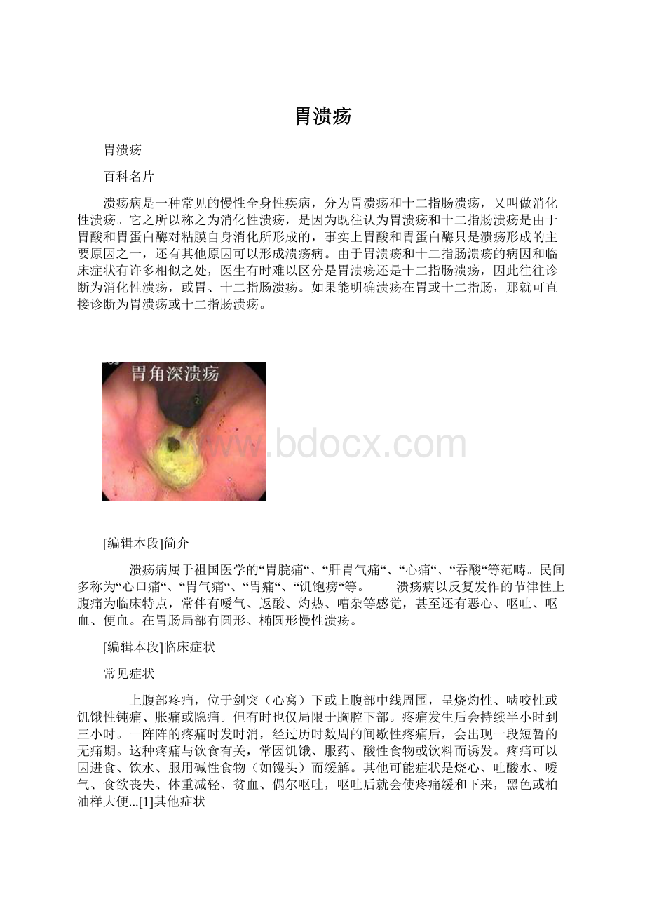 胃溃疡Word文件下载.docx