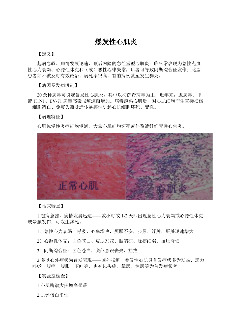 爆发性心肌炎Word文件下载.docx