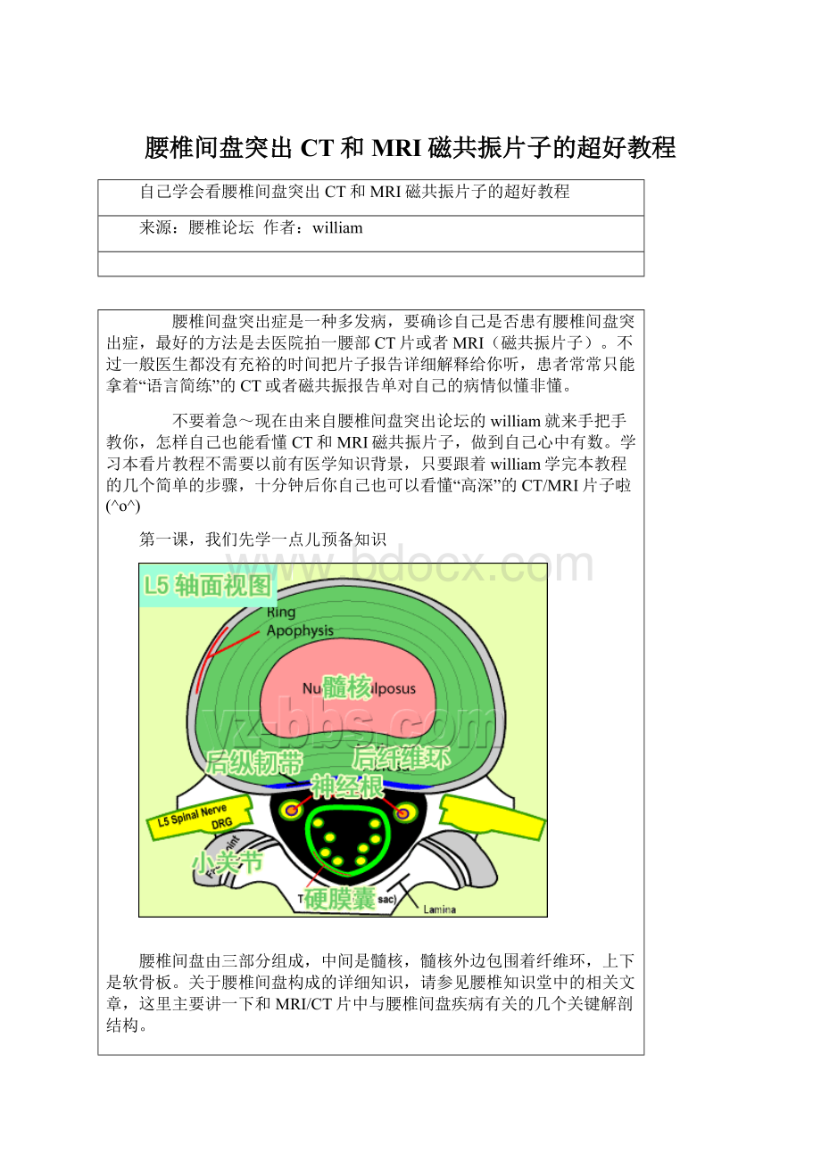 腰椎间盘突出CT和MRI磁共振片子的超好教程Word文档格式.docx_第1页