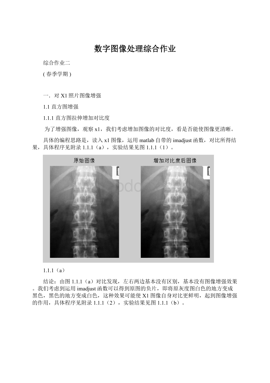 数字图像处理综合作业.docx