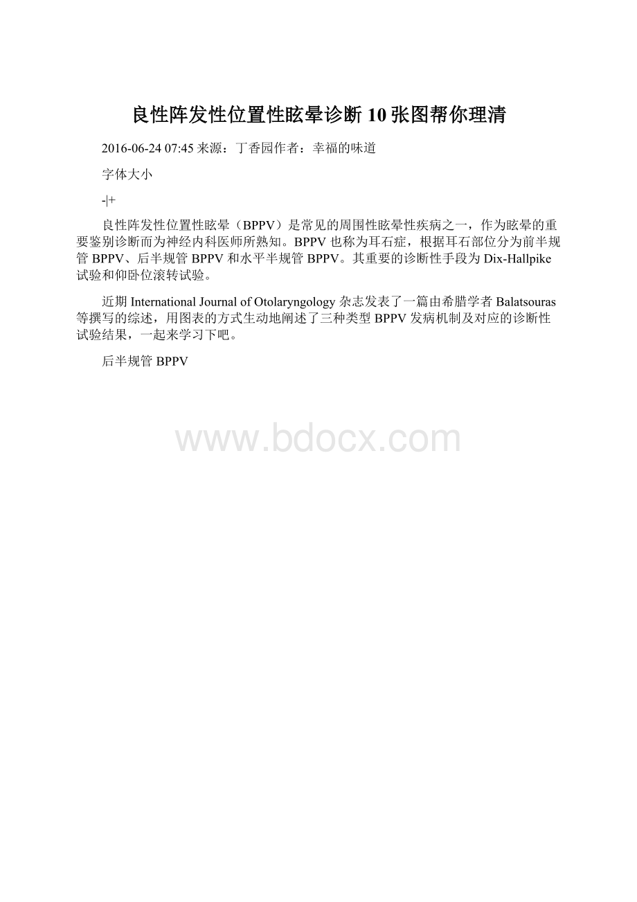 良性阵发性位置性眩晕诊断10张图帮你理清Word文档格式.docx_第1页