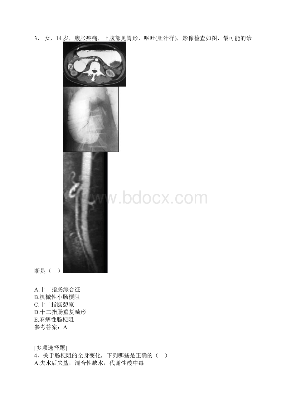 肠梗阻真题精选.docx_第2页