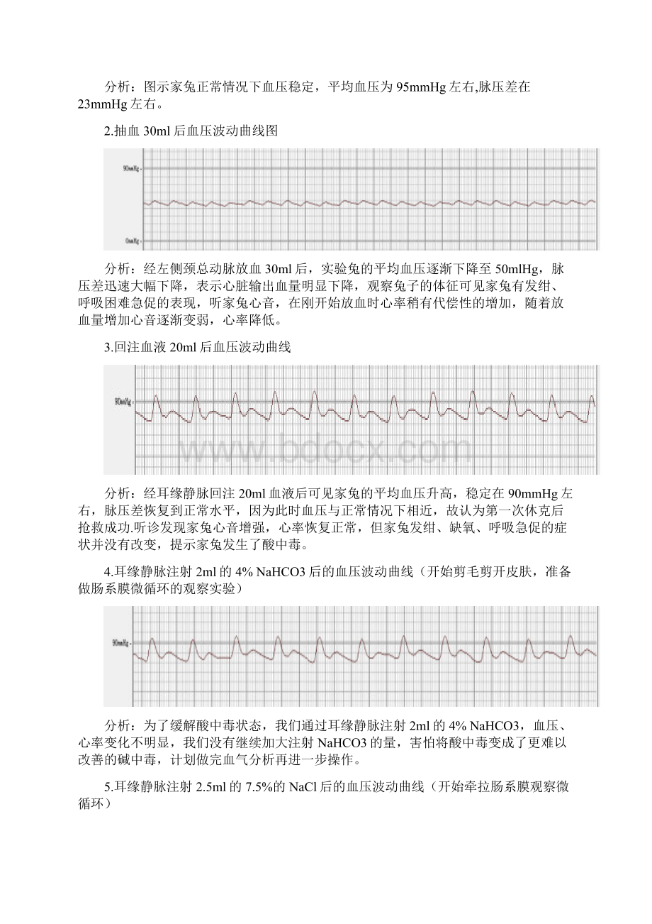 失血性休克及抢救Word下载.docx_第3页