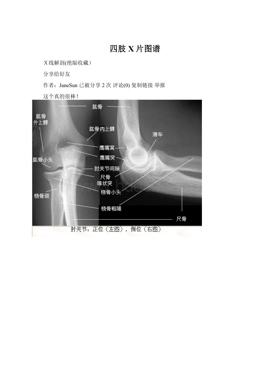 四肢X片图谱.docx_第1页