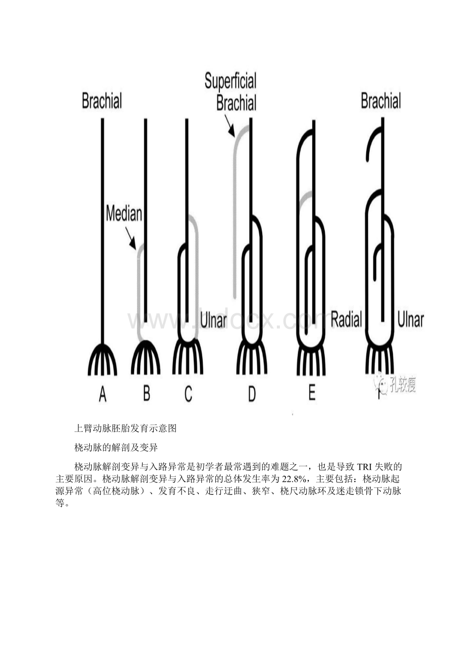 手把手教你桡动脉穿刺技巧精美图文.docx_第2页