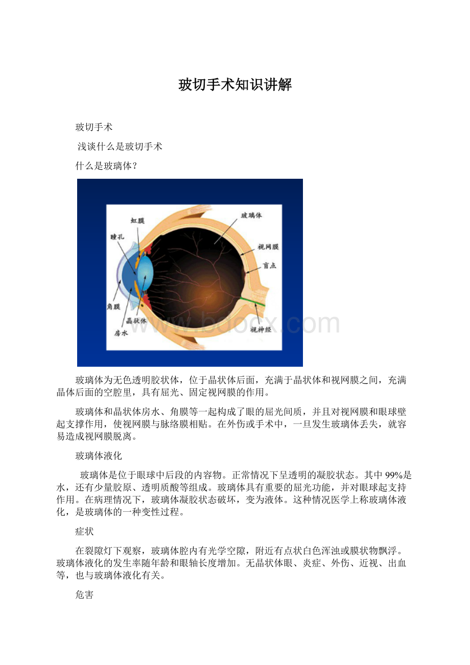 玻切手术知识讲解Word文档格式.docx